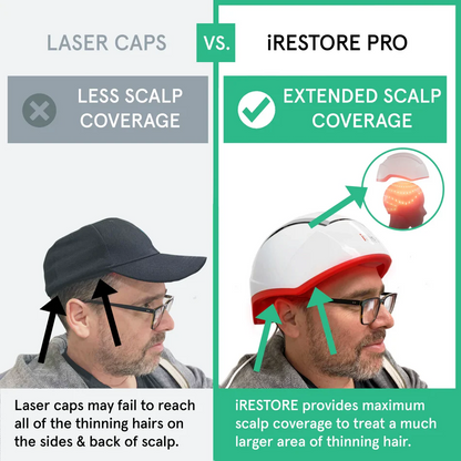 iRestore Professional Laser Hair Growth System