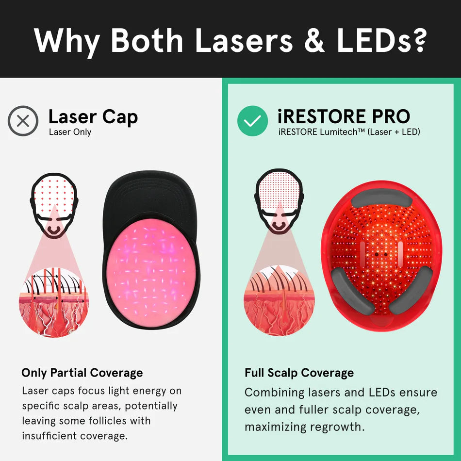 iRestore Professional Laser Hair Growth System
