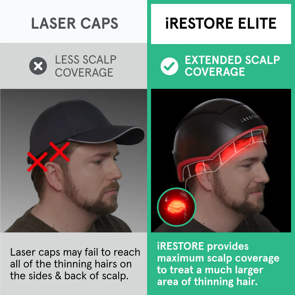 iRestore Elite Laser Hair Growth System
