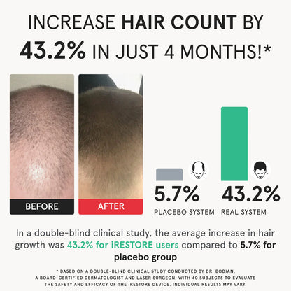 iRestore Professional Laser Hair Growth System
